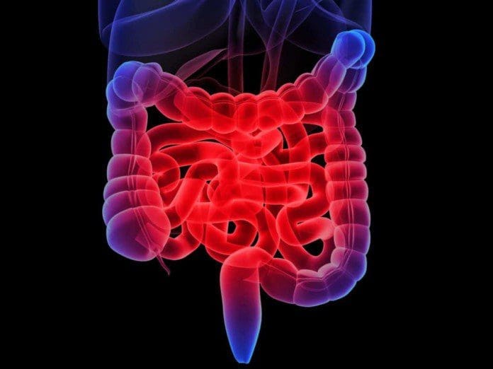 IBD