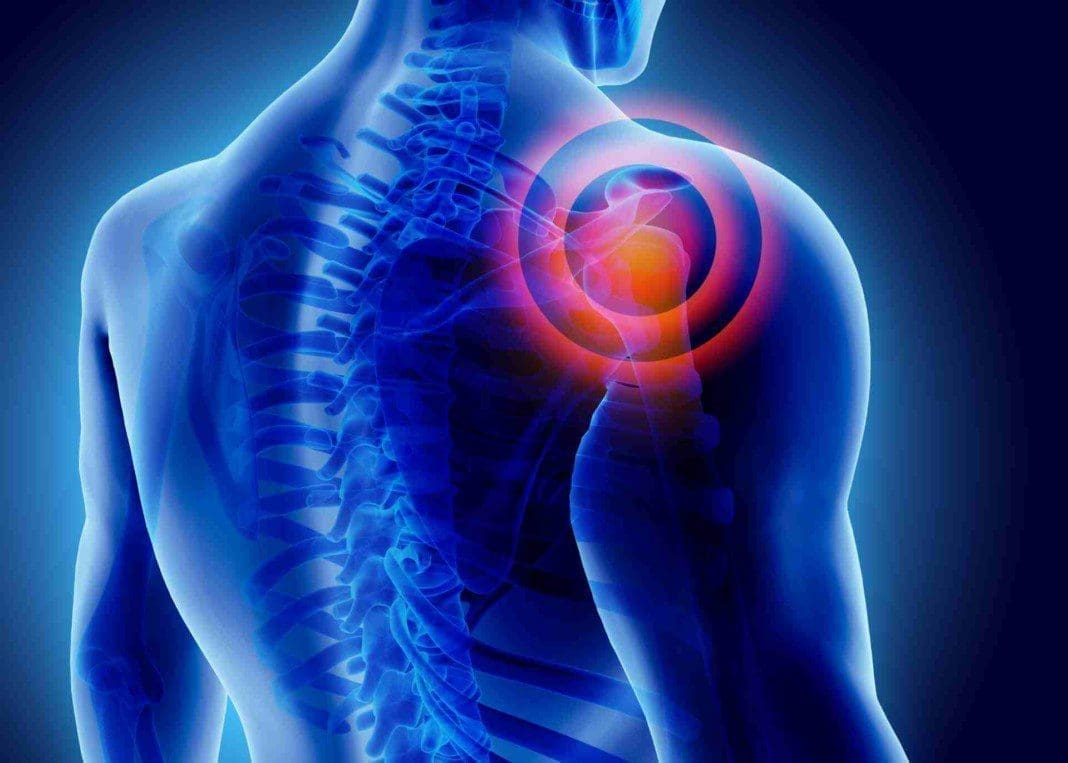 Shoulder-Pain-trigger