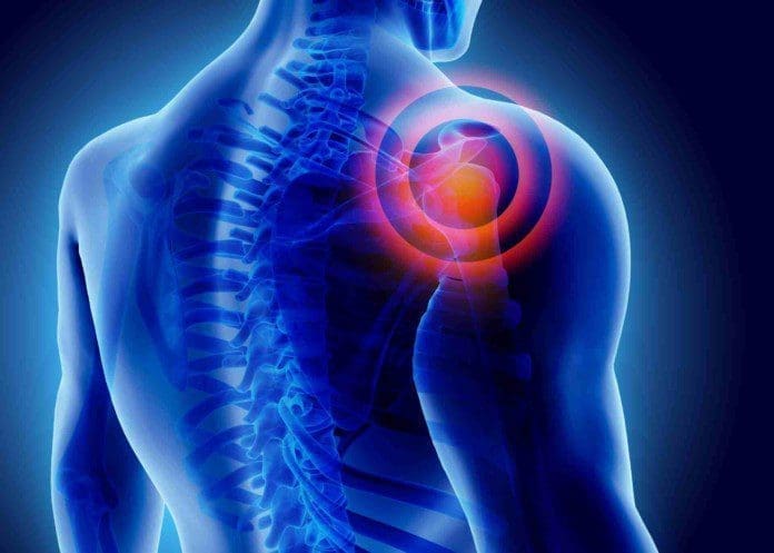 Shoulder-Pain-trigger