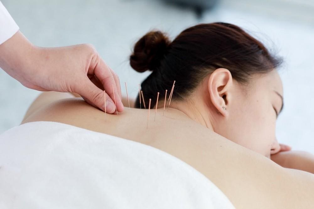fibro-acupuncture