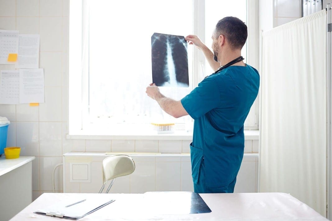 11860 Vista Del Sol, Ste. 128 Spinal Stimulation and Chronic Back Pain