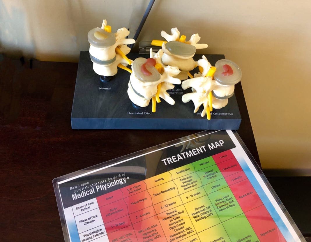 vertebrae-at-the-chiropractors-office-F53VLVN_02