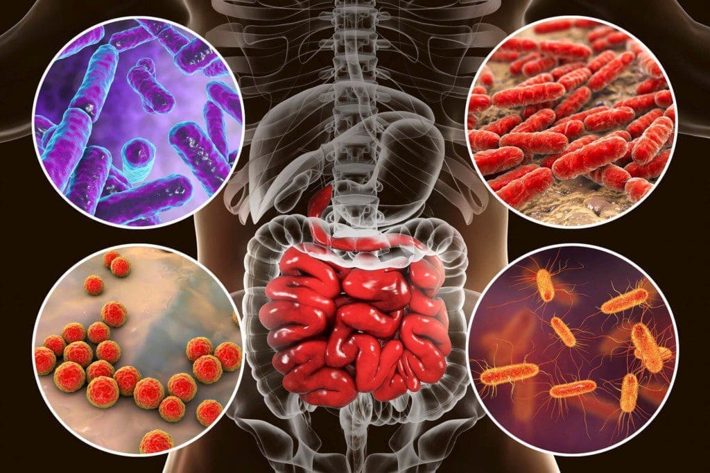 Musculoskeletal Wellness Gut Support for Healing