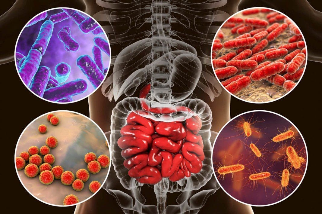 gut microbiota