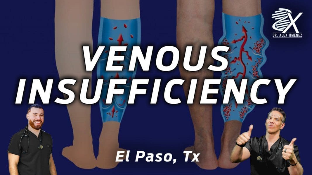 VENOUS