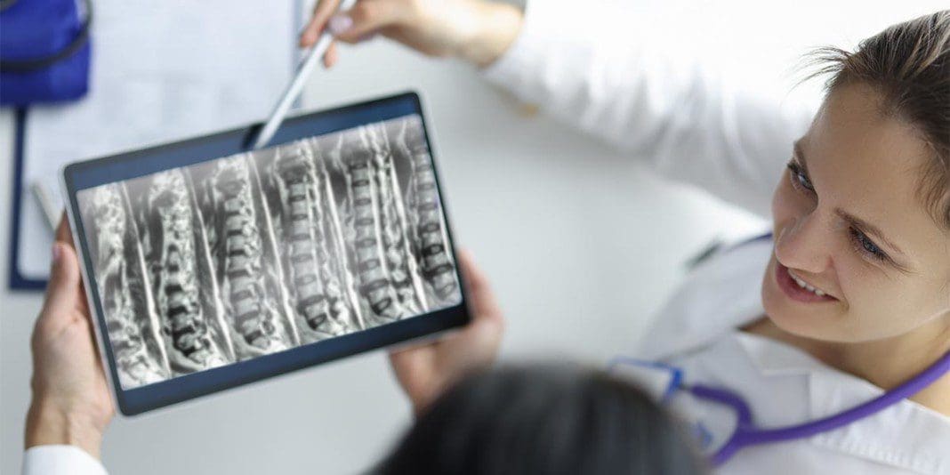 Lumbar_Spine_MRI