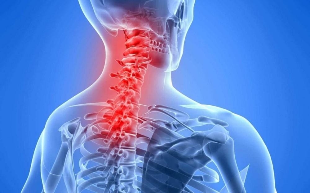 acupuncture-neck-pain