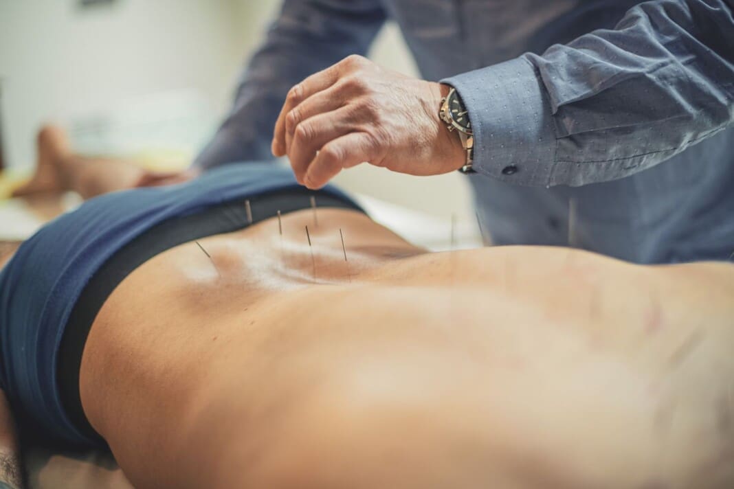 acupuncture-sciatica