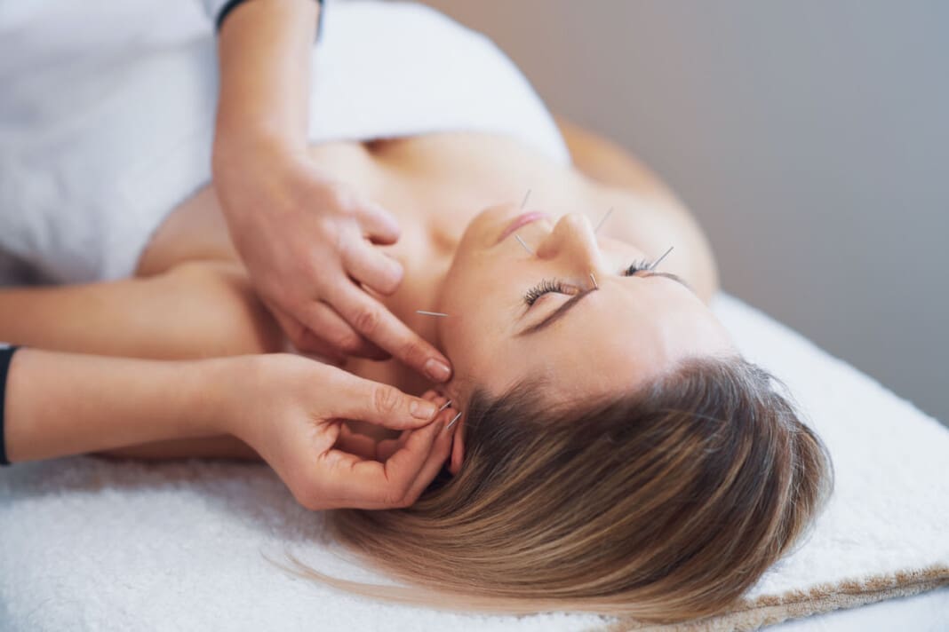 A acupuncture needle therapy in the studio